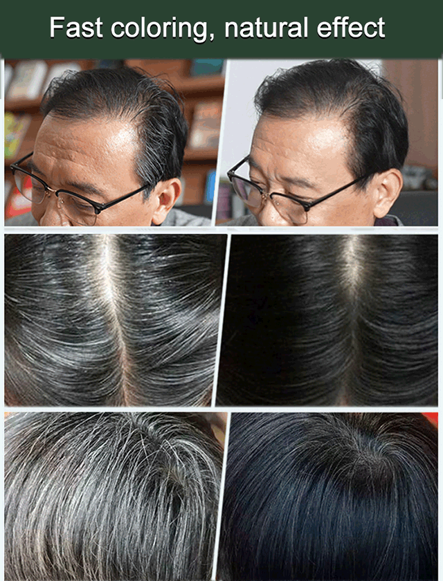 🔥Last Day Sale 50% Off🌿 Plant-Based Hair Color Essence for Gray Hair