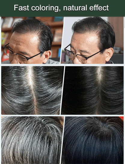 🔥Last Day Sale 50% Off🌿 Plant-Based Hair Color Essence for Gray Hair